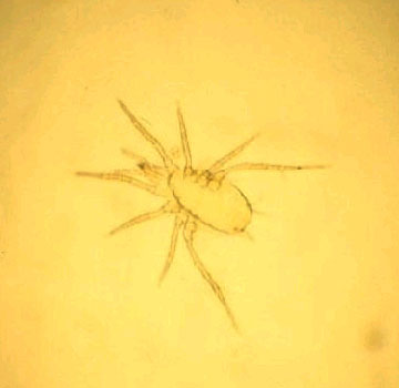 Ejemplar de Phytoseiulus horridus, al microscopio.