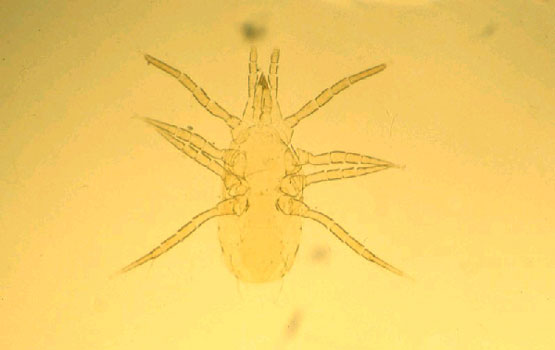 Ejemplar de Anthoseius renanoides, al microscopio.