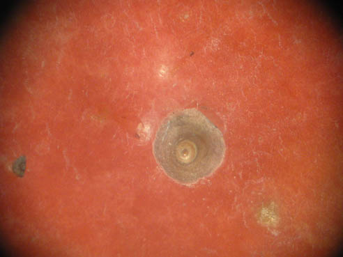 Caparazón de hembra.