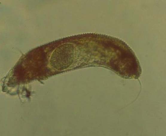 Phytoptus pyri (imagen tomada con el microscopio).